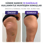 VELNORA™ Roller Pro Masaj Aleti