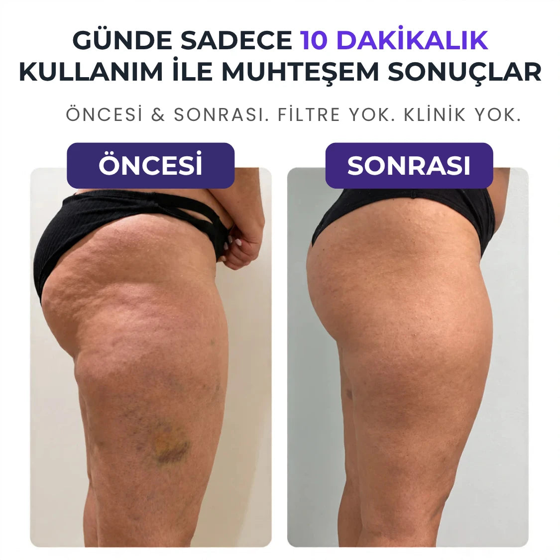 VELNORA™ Roller Pro Masaj Aleti