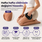 VELNORA™ Roller Pro Masaj Aleti
